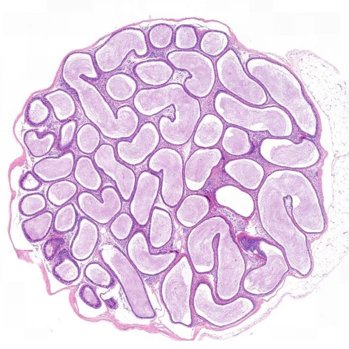 360f883ffbd8d23e1e3aba242bf6c251